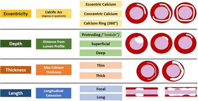 The role of invasive and non-invasive imaging technologies and calcium modification therapies in the evaluation and management of coronary artery calcifications